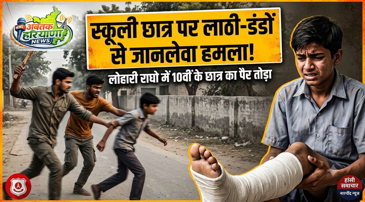हांसी समाचार: नारनौंद में छात्र पर हमला, लोहारी राघो के किशोर के पैर में फ्रैक्चर